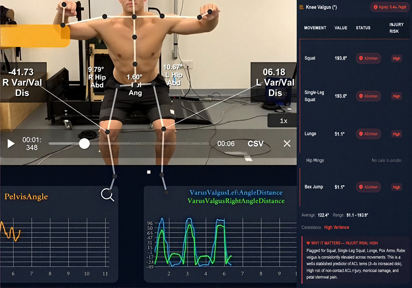 Pelvic stability injury risk assessment showing movement values, status, and risk levels